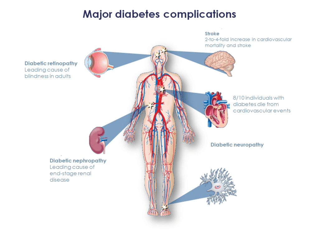 Major diabetes complications